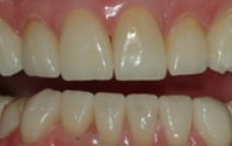 Healthy beautifully repaired smile after cosmetic and restorative dentistry